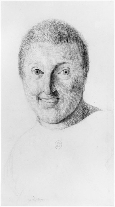Epileptic Woman, Front View by Georges Francois Gabriel